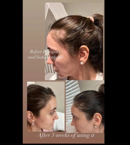 ⁦زيت التنبيت من Kitsch Rosemary Oil بالروز ماري والبيوتين⁩ - الصورة ⁦3⁩